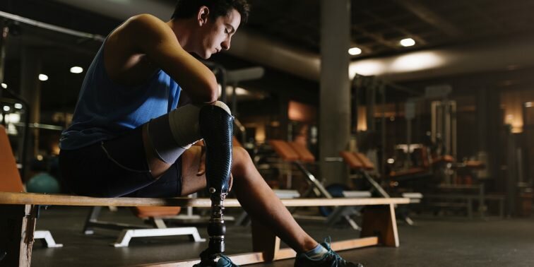 Picture of man with prosthetic limb in gym.
